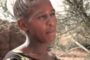 Albinism Attack - Bariadi Tanzania